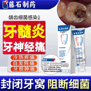 药监备案牙髓炎牙龈神经肿疼止痛特专可用搭非牙膏药贴效喷雾剂YY
