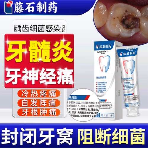 藤石制药牙髓炎牙神经疼痛