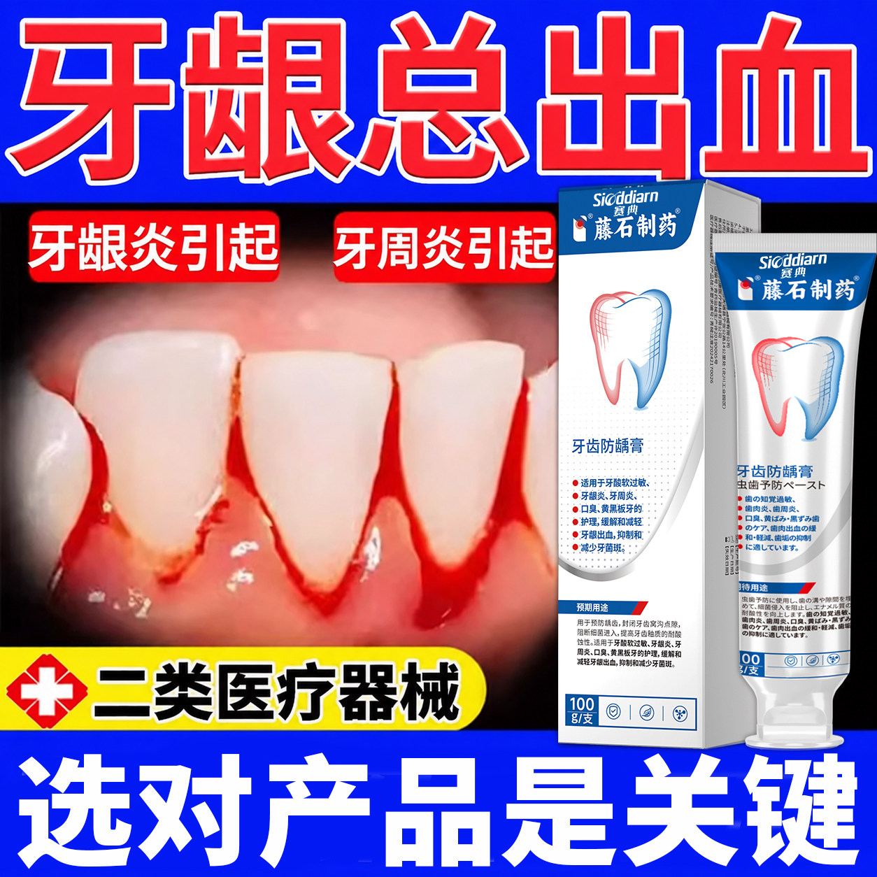 牙龈出血牙周炎牙齿止血口腔的口臭肿痛萎缩漱口水非牙膏YU