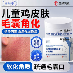 儿童医用去鸡皮肤疙瘩毛囊角化角质毛周角化药膏面霜青少年手臂ZY