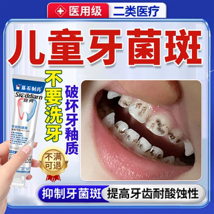 儿童非牙膏去牙菌斑黑牙牙膏黑斑黑色素沉淀氟可搭专用祛除牙膏ON