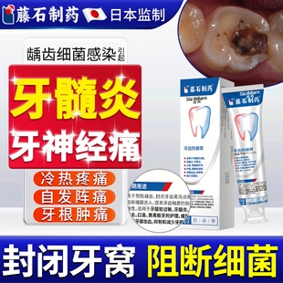 药监备案牙髓炎牙龈神经肿疼止痛特专可用搭非牙膏药贴效喷雾剂YY