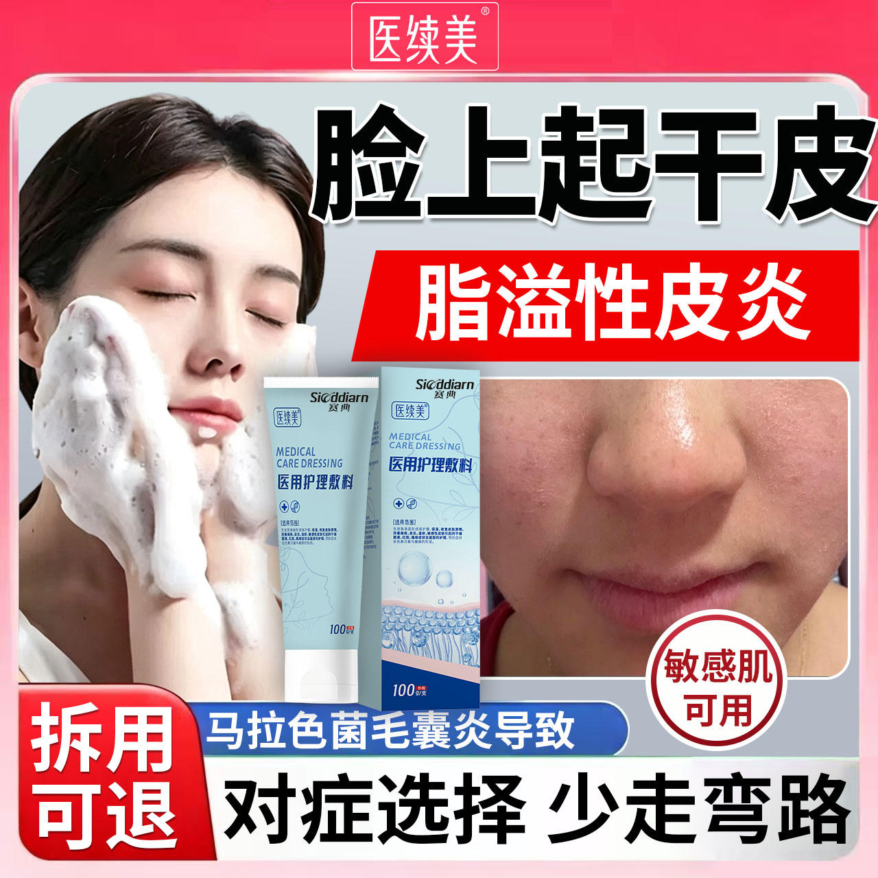 面部脂溢性皮炎脸部鼻翼鼻子两侧泛红脱皮马拉色菌搭洗面奶修复ZY