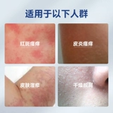 Детский гель от экземы против сухости, против зуда, пилинг