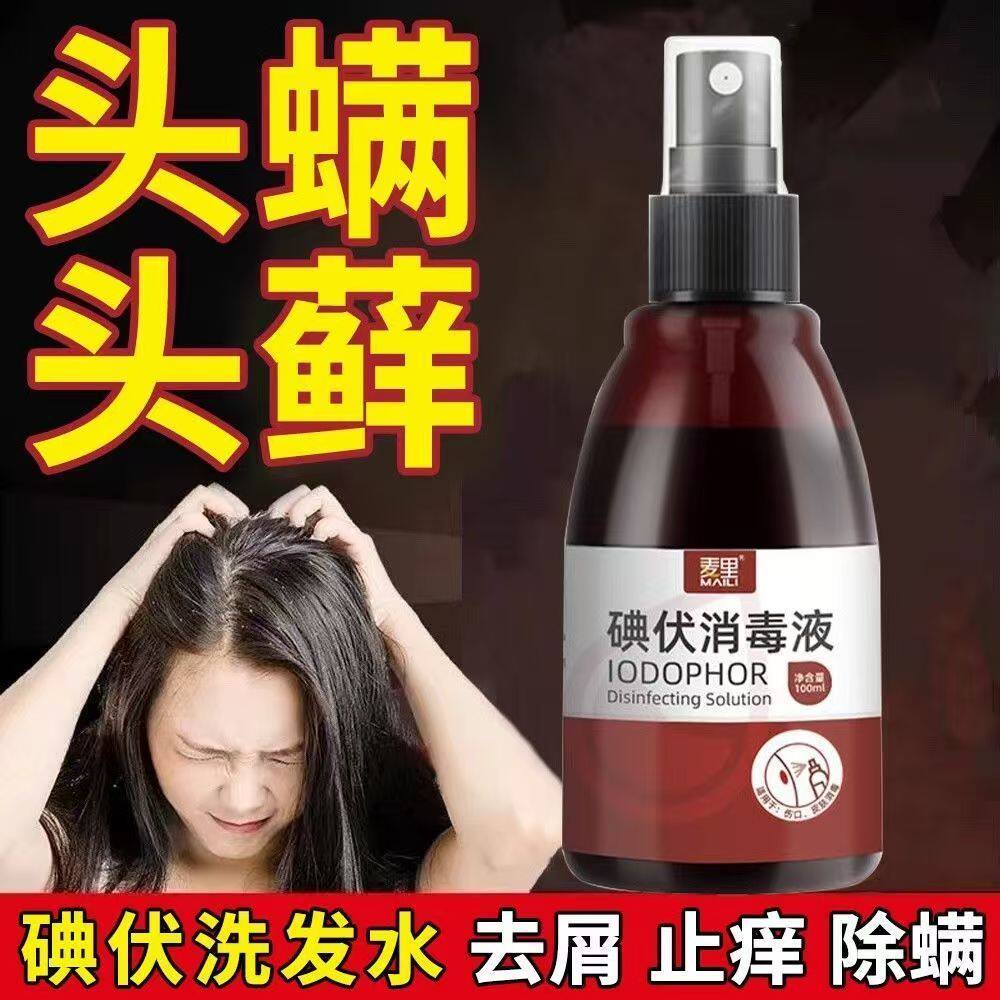 碘伏洗发水洗头发控油去屑止痒头屑严重消毒液喷雾杀菌消毒典伏