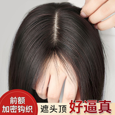 怡泽升级递针大面积隐形补发片