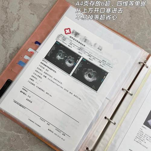 病厉收纳册a4病理档案记录册