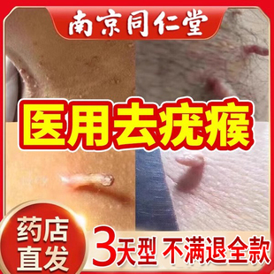 扁平疣丝状尤祛脖子上长小肉粒瘊子一抹灵非去疣药膏除神器清宁