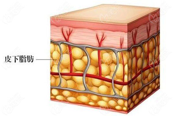 【碎脂z】afeather倍克脂细b液5ml 消 碎 缩 韧带重塑非液化