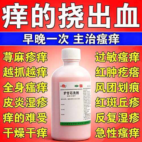 荨麻疹湿疹皮炎丘疹过敏止痒专用抑菌皮肤瘙