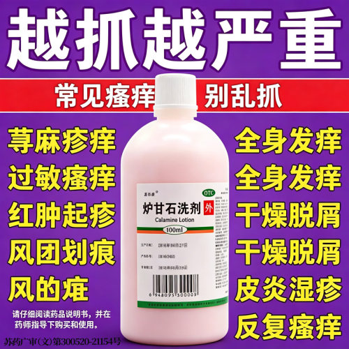 荨麻疹湿疹皮炎丘疹过敏止痒专用抑菌皮肤瘙
