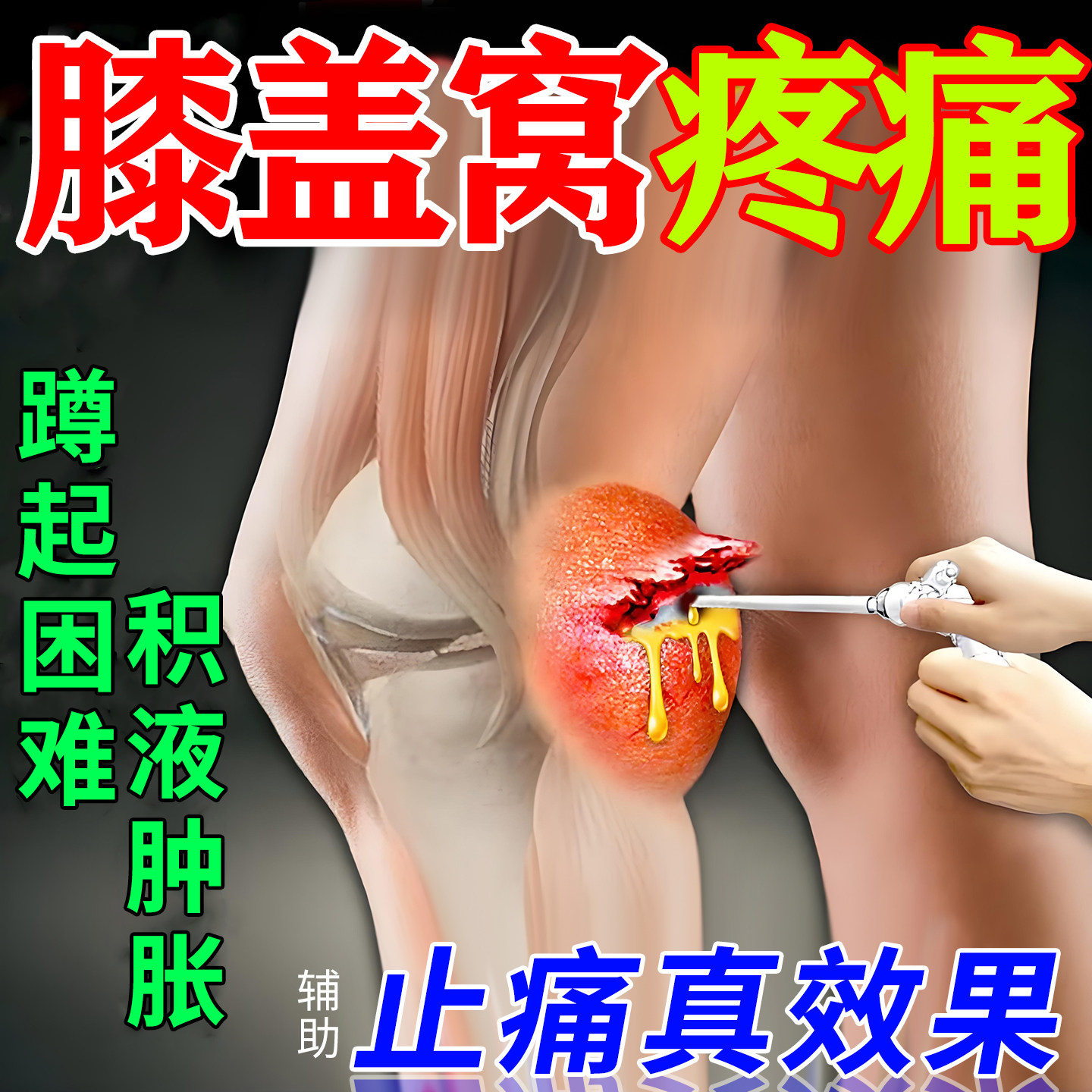 腘窝囊肿特专用膏药贴效腿膝盖后窝筋疼鼓包肿胀疼痛关节积液凝胶