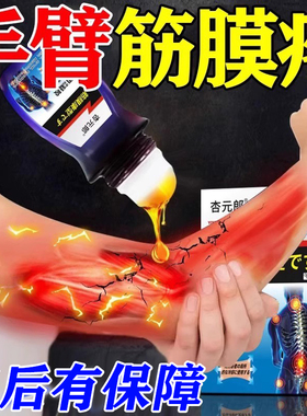 手臂筋膜疼痛专手臂肌肉筋膜酸胀用疼痛手臂胳膊疼痛筋骨医用凝胶