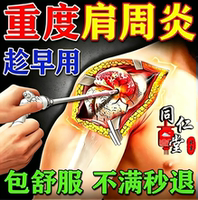 肩周炎专用贴膏热敷抬臂无力活动受限关节僵硬酸痛肩周劳损旗舰店