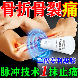 骨折骨裂恢跌打损伤复膏药快速愈接合骨续筋伤筋动骨活血化瘀凝胶