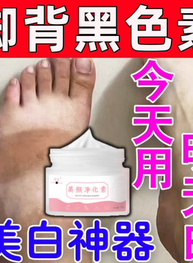 脚背黑印黑色素沉淀凉鞋印脚面发黑专用去脚丫上死皮全身美白神器