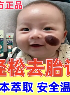 儿童胎记去除神器天生胎记脸部淡化黑板黑色素太田痣咖啡斑修复膏