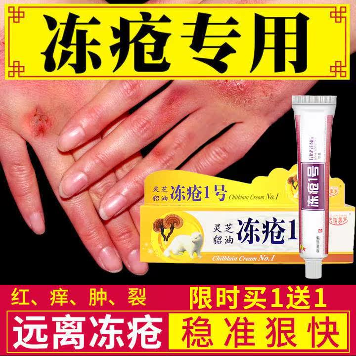 冻疮膏治根冻疮一号冻疮乳膏止痒手脚跟干裂口耳冻护手霜预防冻ss