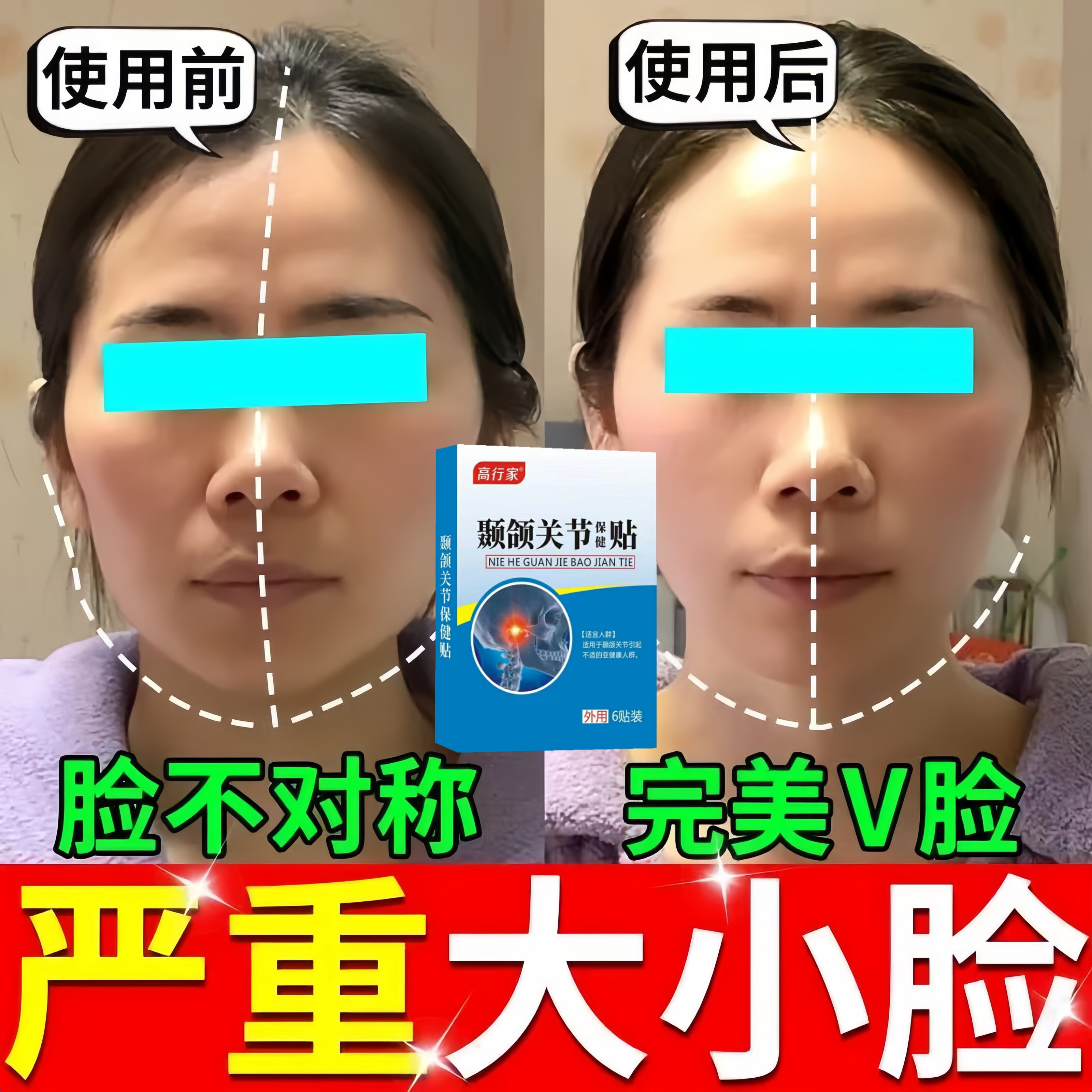 颞下颌关节紊乱热敷贴防下巴后缩张口弹响大小脸矫正神器凝胶颌垫