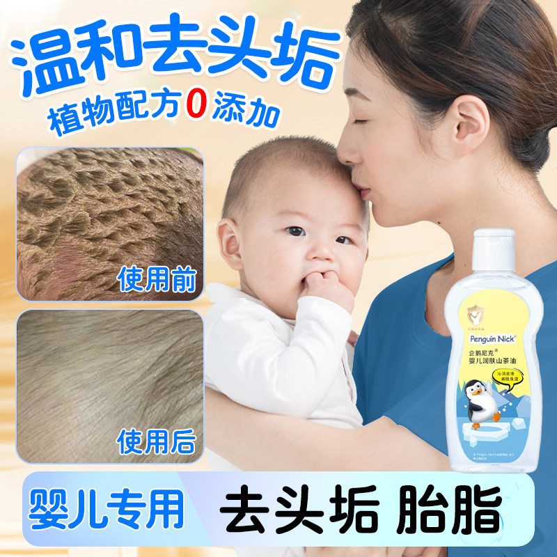 婴儿油去黑头乳痂新生儿软化头皮垢神器头垢油宝宝胎脂专用抚触油
