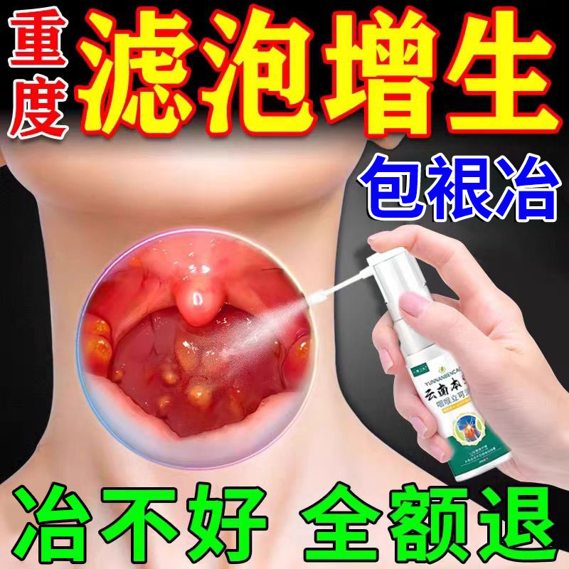 【一抹消泡】专治慢性咽炎咽喉炎