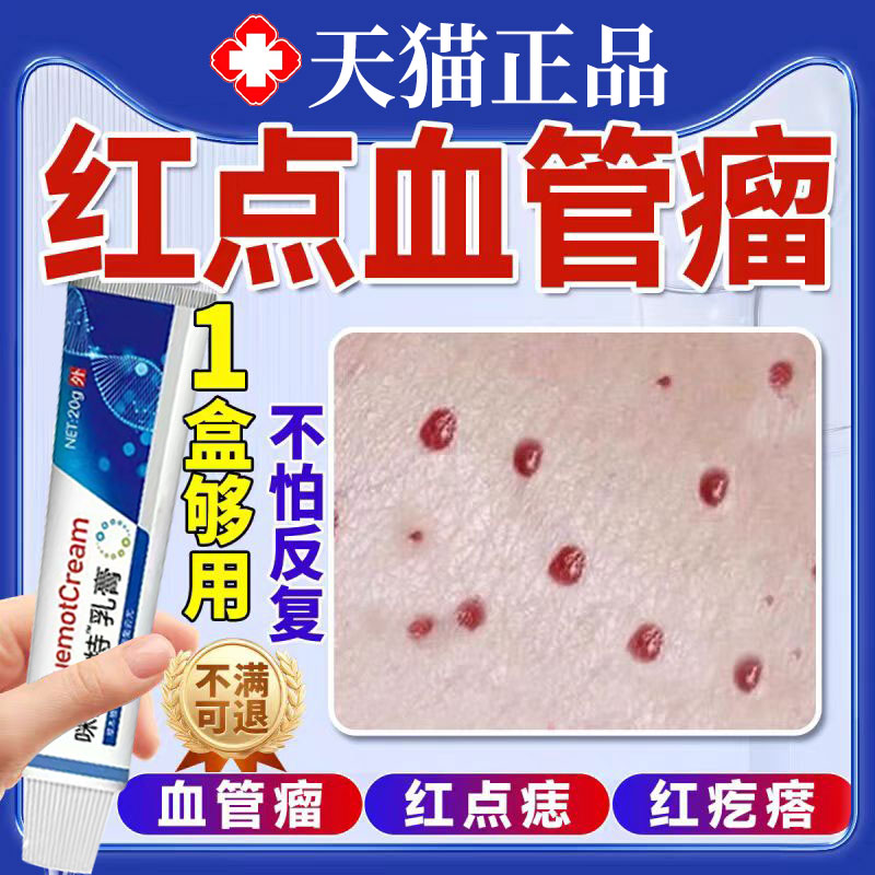 【血管瘤】去除血管瘤医用级药膏