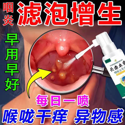 【一喷消泡】专治慢性咽炎咽喉炎
