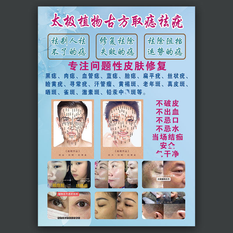 男女面痣图去痣脸部祛痣图片挂古方植物祛疣广告画祛斑z海报点痣
