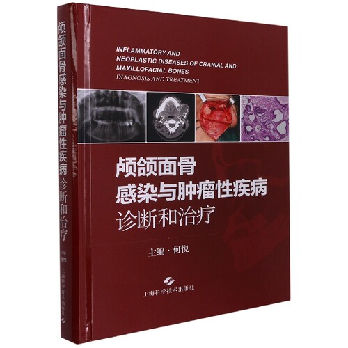 颅颌面骨感染与肿瘤性疾病：诊断和治疗