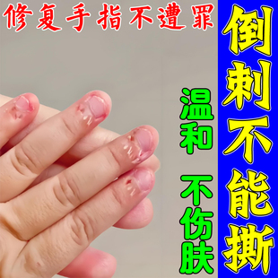 儿童手指倒刺修复霜受损再生营养油护理去刺软膏防小孩手上干裂脱
