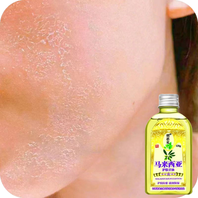 脸起皮干燥起皮掉皮脸干燥泛红脸干痒季脸部爆皮起皮卡粉掉皮甘油