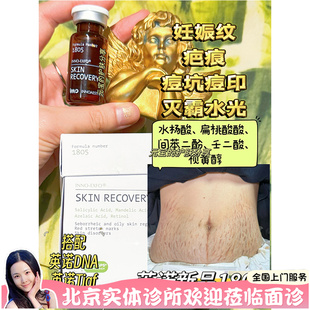 西班牙英诺1805去妊娠纹瘢痕TCA精华液5ml 痘坑痘印巴痕涂抹强酸