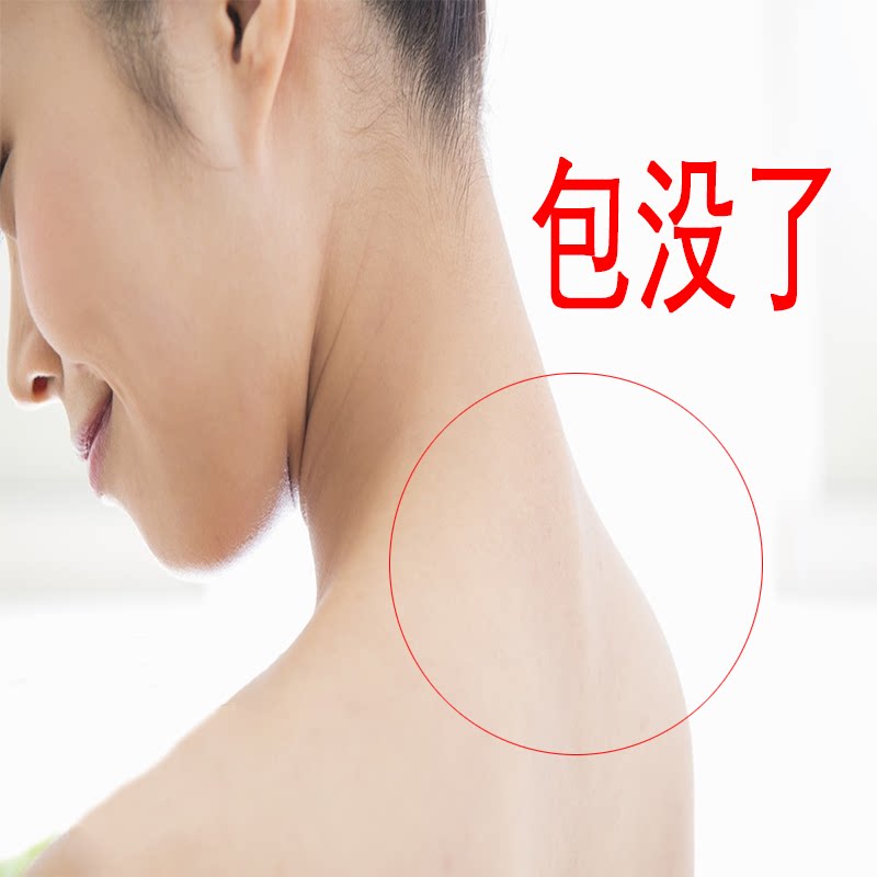 解决各种颈椎问题 只要富贵不要包 富贵包消除贴专用