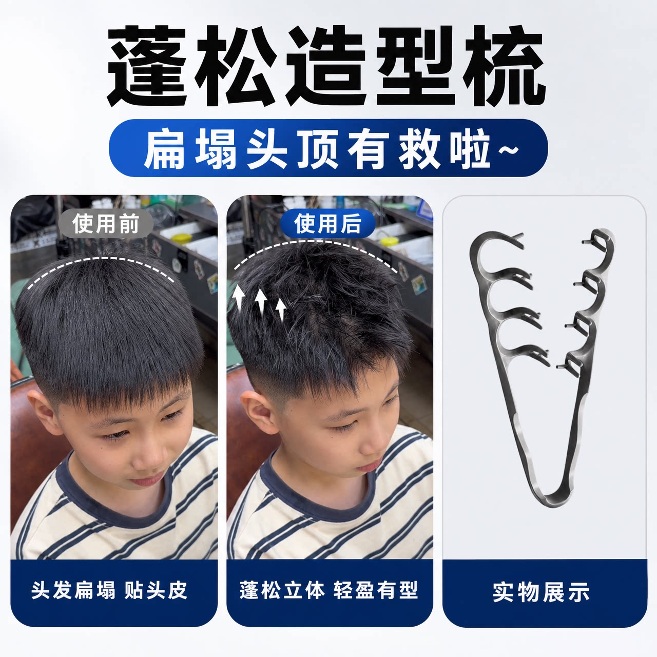 蓬松纹理造型梳高颅顶神器发根