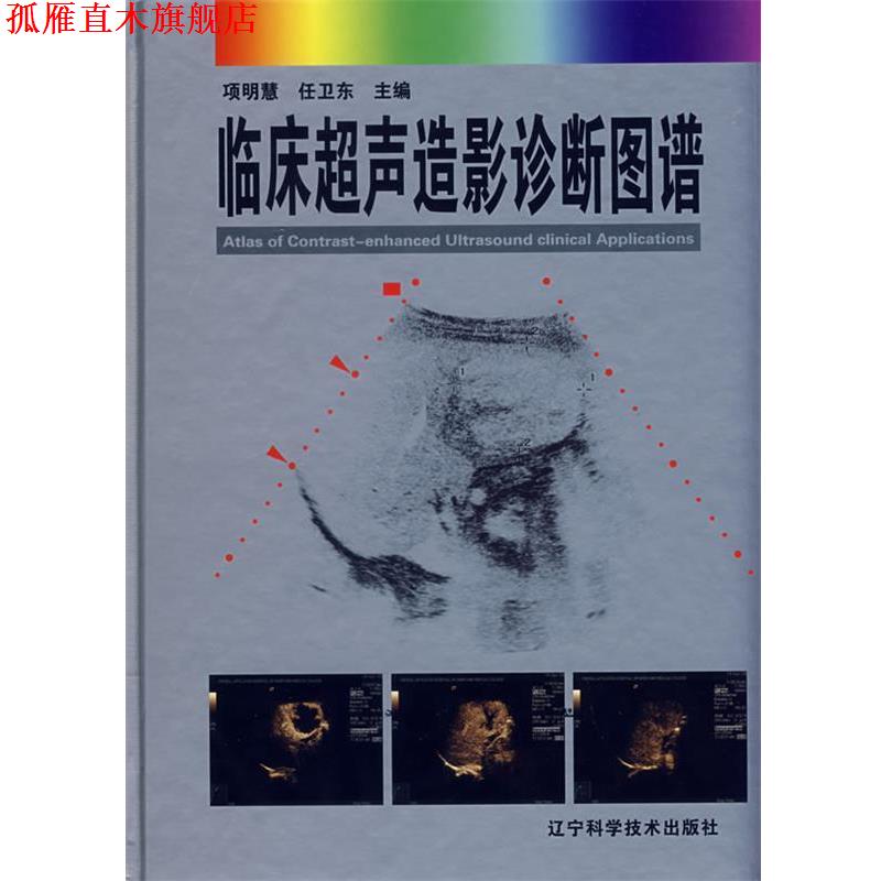 【正版书】 临床超声造影诊断图谱 项明慧,任卫东 主编 辽宁科学技术出版社