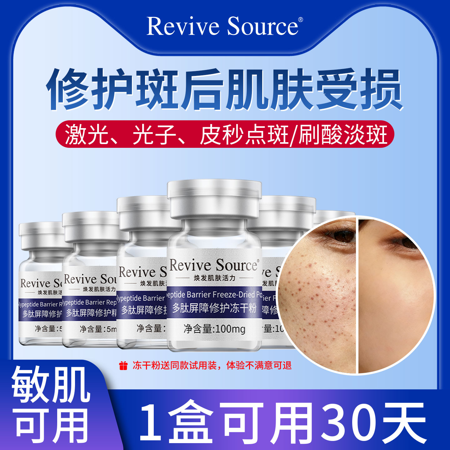 冻干粉修护点斑点痣后屏障受损