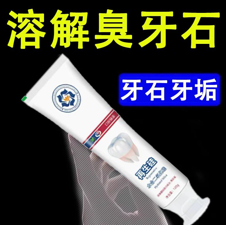 不用去洗牙【刷白了】牙石牙垢嘴巴臭亮白去牙石去渍烟渍牙膏