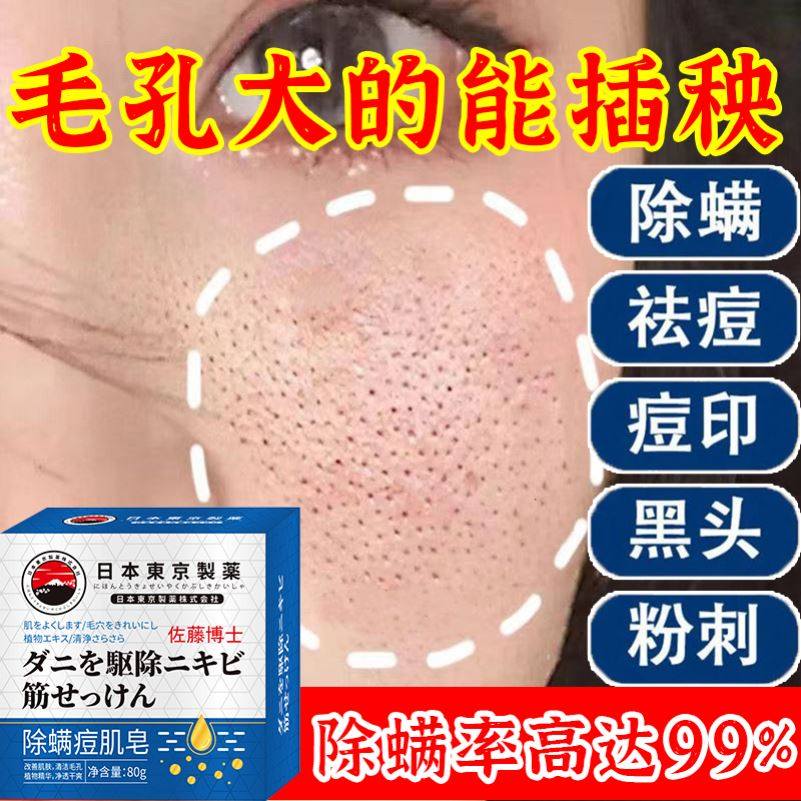 【爆款热售】祛痘修复淡化痘印去痘痘痘坑痘疤香皂男女士