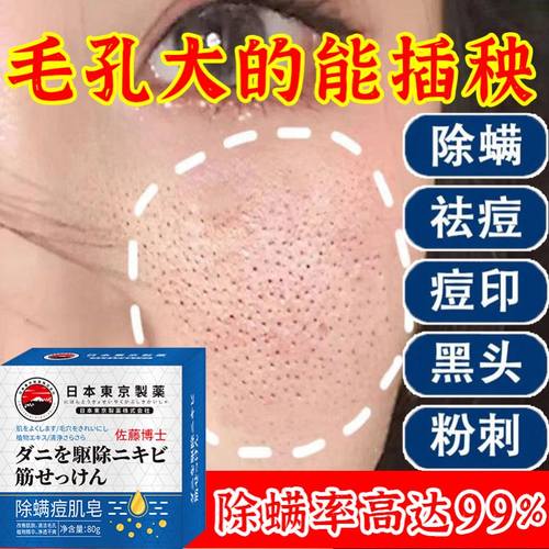 【现货热卖】祛痘修复淡化痘印去痘痘痘坑痘疤香皂男女士