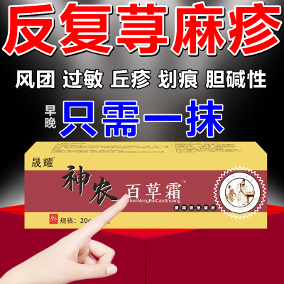 荨麻疹20g多买多送止痒皮肤瘙痒