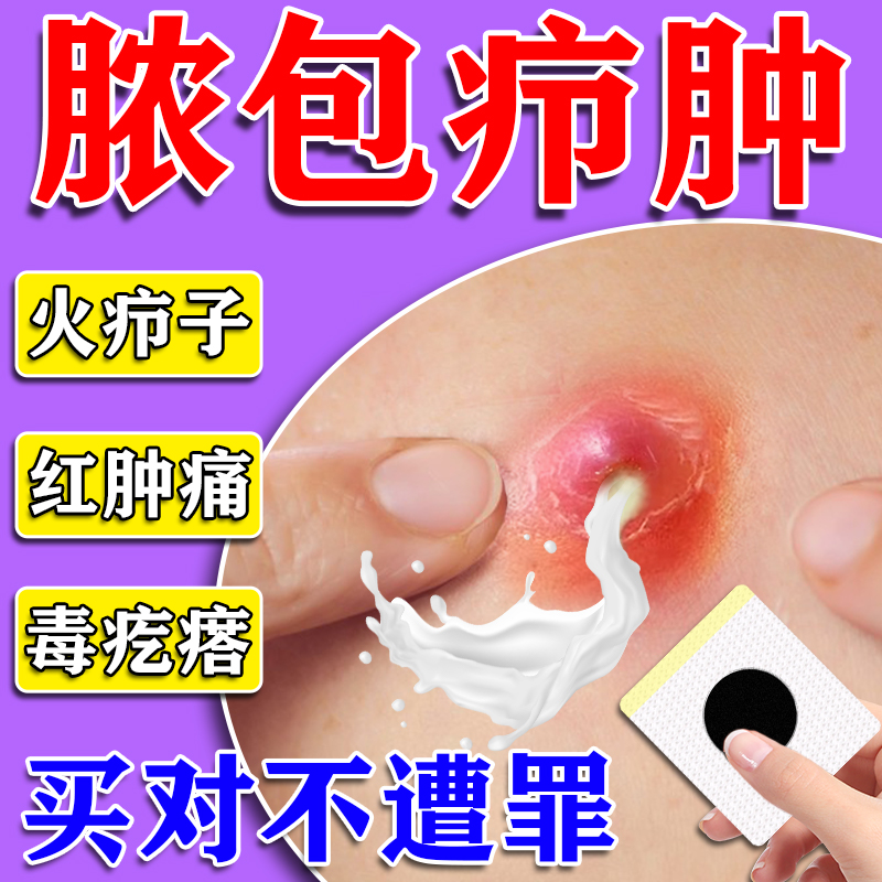 疖肿拔毒膏火疖子拔脓药膏皮脂腺囊肿去除屁股上长痘红肿硬块神器