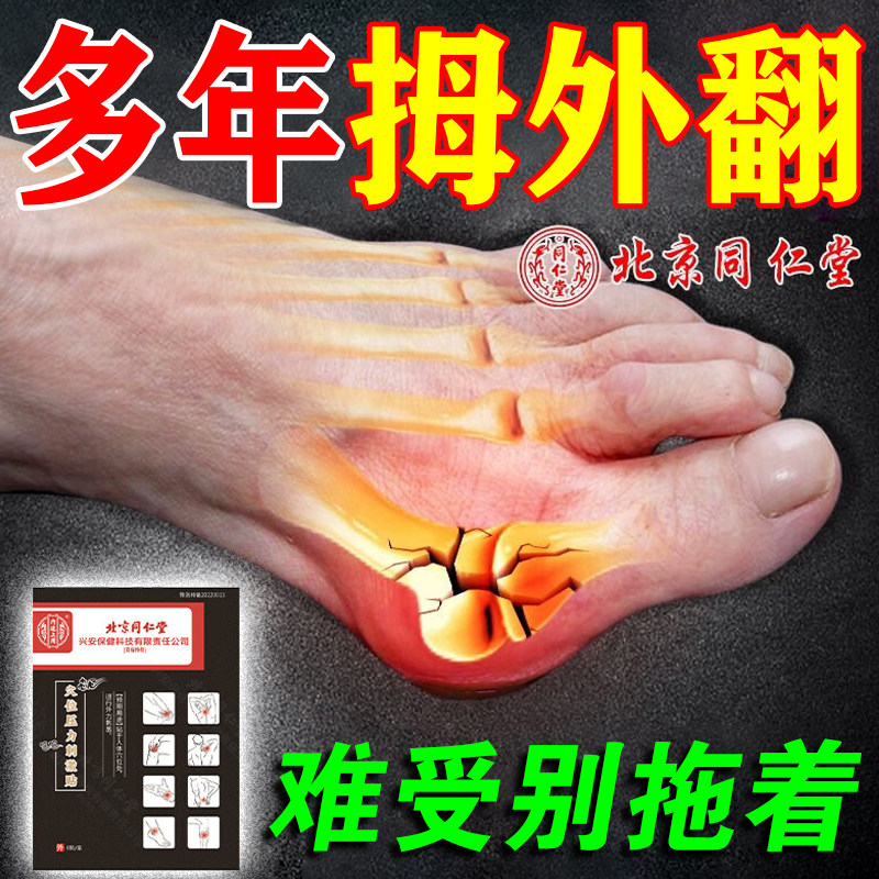 拇指外翻膏药贴大拇指疼痛大脚骨关节畸形矫正拇囊炎突出药膏贴