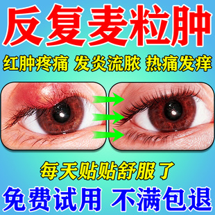 麦粒肿眼贴热敷霰粒肿干眼症儿童蒸汽眼罩睑板腺囊肿疏通堵塞眼罩