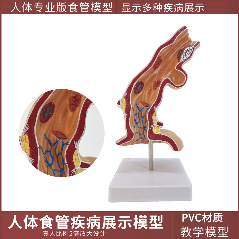 食管模型,气管食管(第3页)_大山谷图库