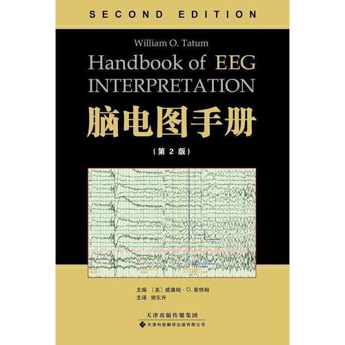 【正版书】 脑电图手册 [美]威廉姆·O.泰特姆　主编 天津科技翻译出版公司