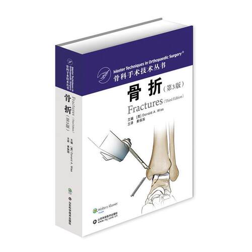 【正版书】 骨折 唐纳德A威斯　著 山东科学技术出版社
