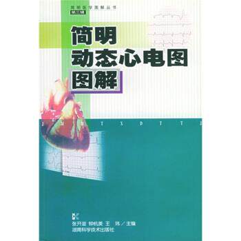 【正版书】 简明动态心电图图解 张开滋,钟杭美,王玮 湖南科学技术出版社