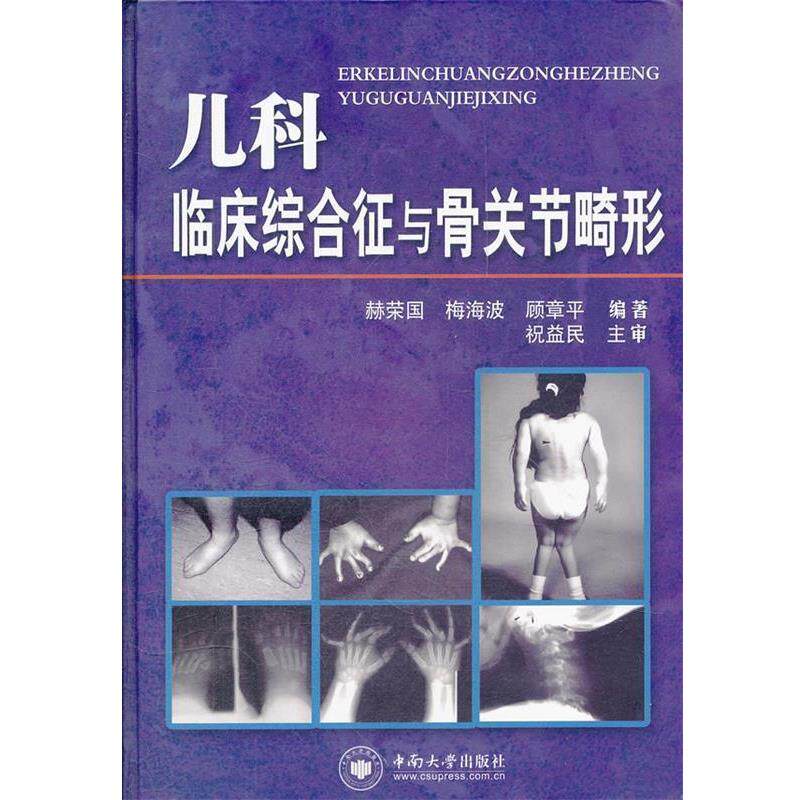 【正版书】 儿科临床综合征与骨关节畸形 赫荣国　等编著 中南大学出版社