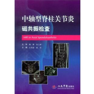 【正版】中轴型脊柱关节炎磁共振检查 王炎焱 赵征
