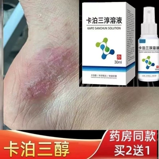 卡泊三醇倍他米松软膏正品官方旗舰店卡泊三醇搽剂凝胶喷雾剂30g